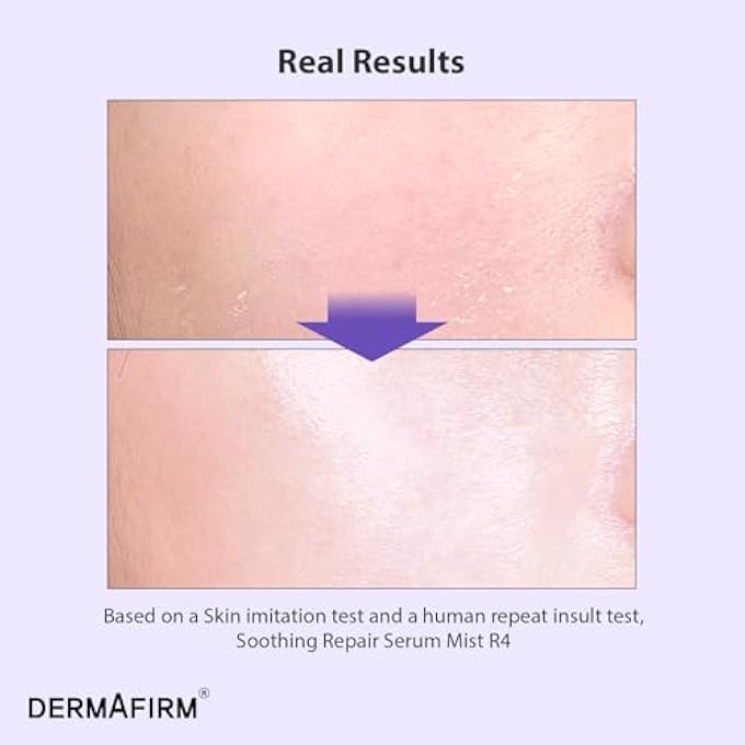 Dermafirm SOOTHING REPAIR FACIAL SERUM HYDRATING MIST R4 | FACE MIST HYDRATING SPRAY FOR DARK SPOTS W/EUCALYPTUS, PEPTIDE & COLLAGEN | GENTLE FOR ALL SKIN TYPES NO ANIMAL TRIALS NO PARABEN 3.38 FL OZ - Image 2